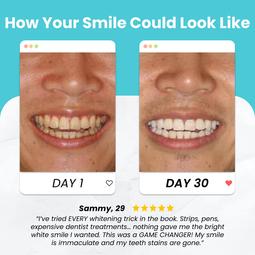 electric toothbrushes